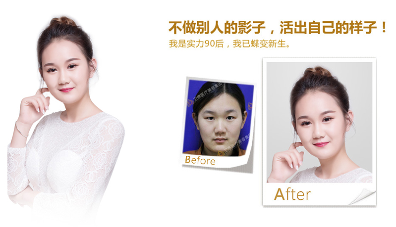 郴州纳米脂肪移植