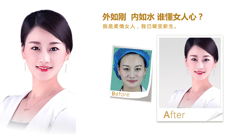 郴州V脸、线雕隆鼻